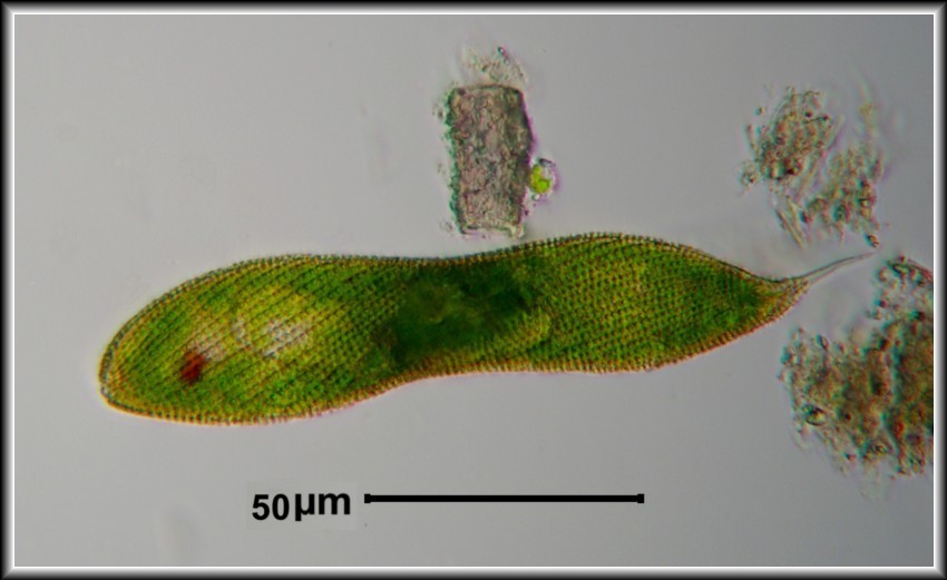 Foto 4 - Euglena spirogyra